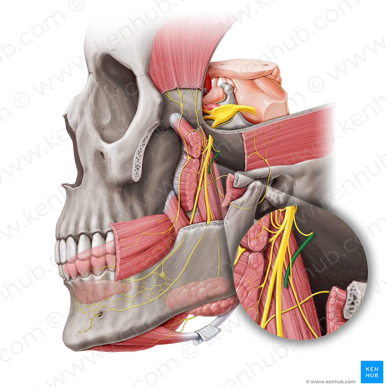 Middle meningeal artery (#1507)