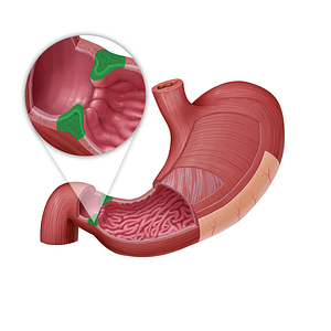 Pyloric sphincter (#21597)