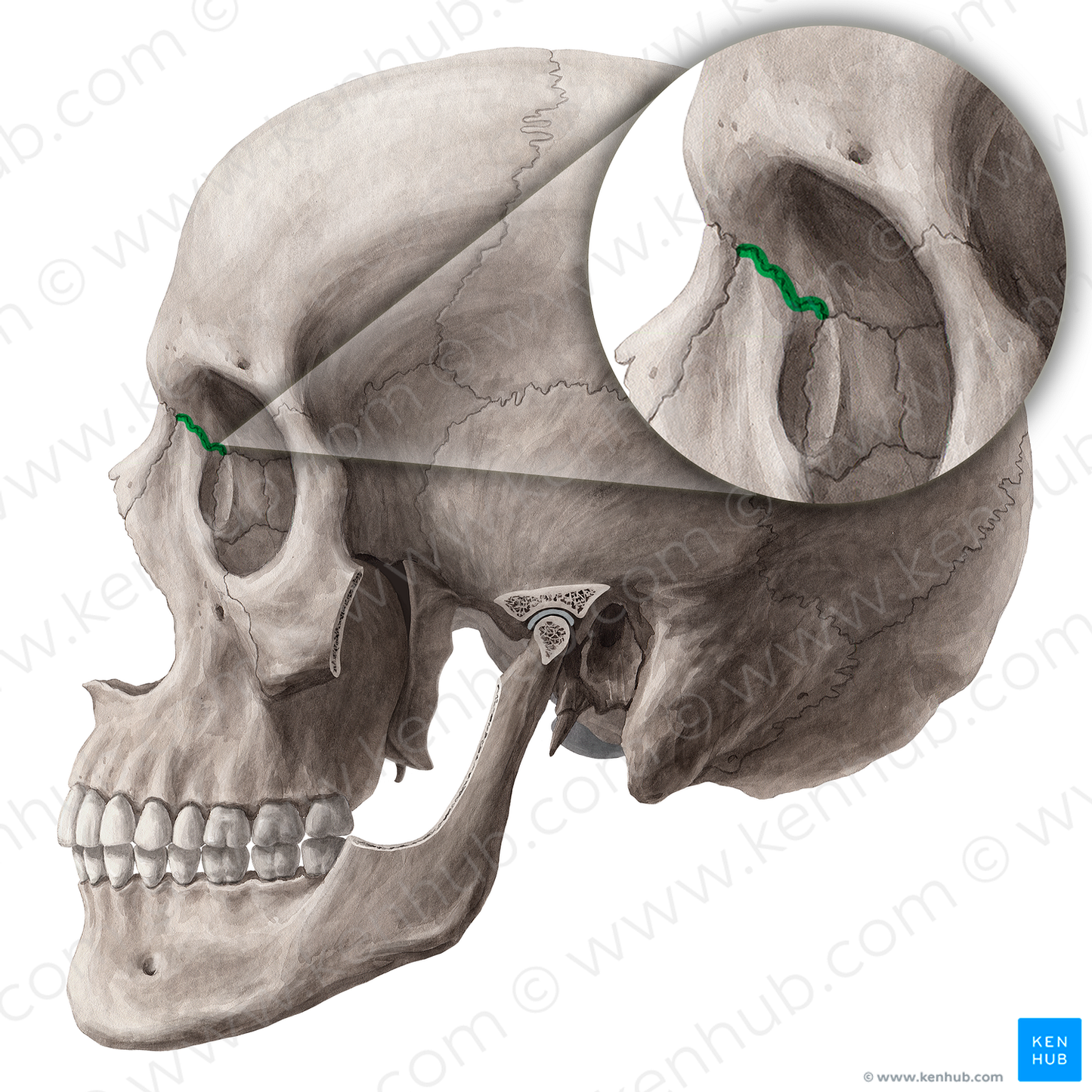 Frontomaxillary suture (#21457)