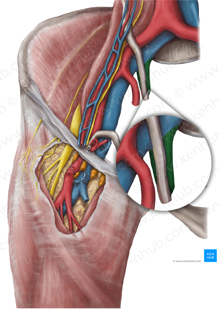 Internal iliac vein (#10318)