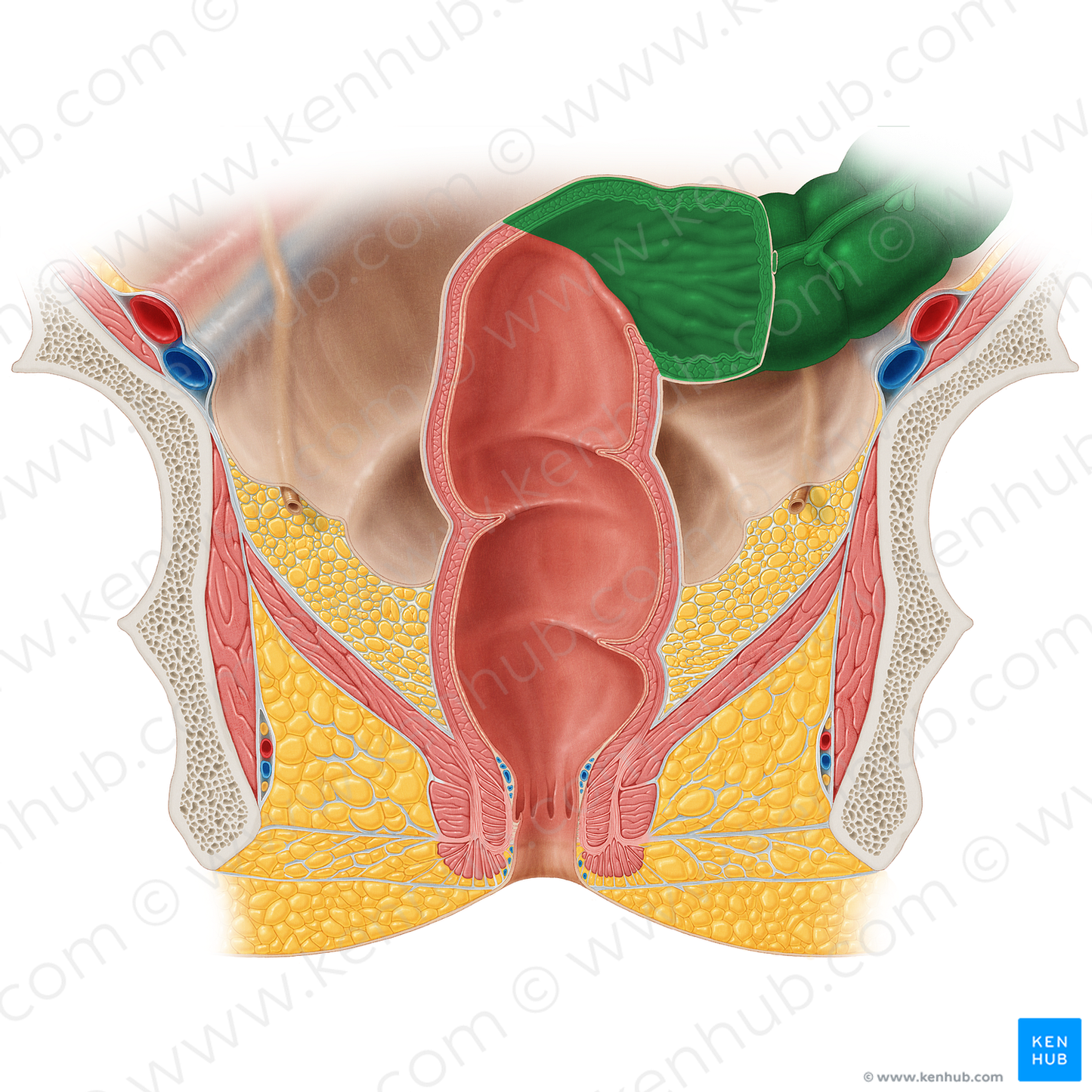 Sigmoid colon (#11001)