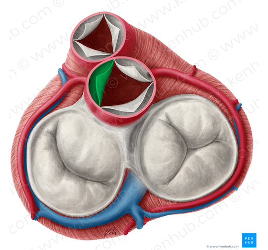 Left coronary leaflet of aortic valve (#9925)