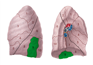 Lateral basal segment of left lung (#20703)