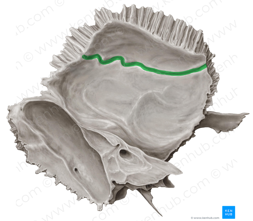 Groove for middle meningeal artery of temporal bone (#9221)