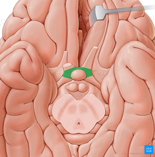 Optic chiasm (#2593)