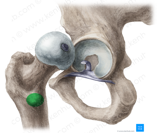 Lesser trochanter of femur (#9578)