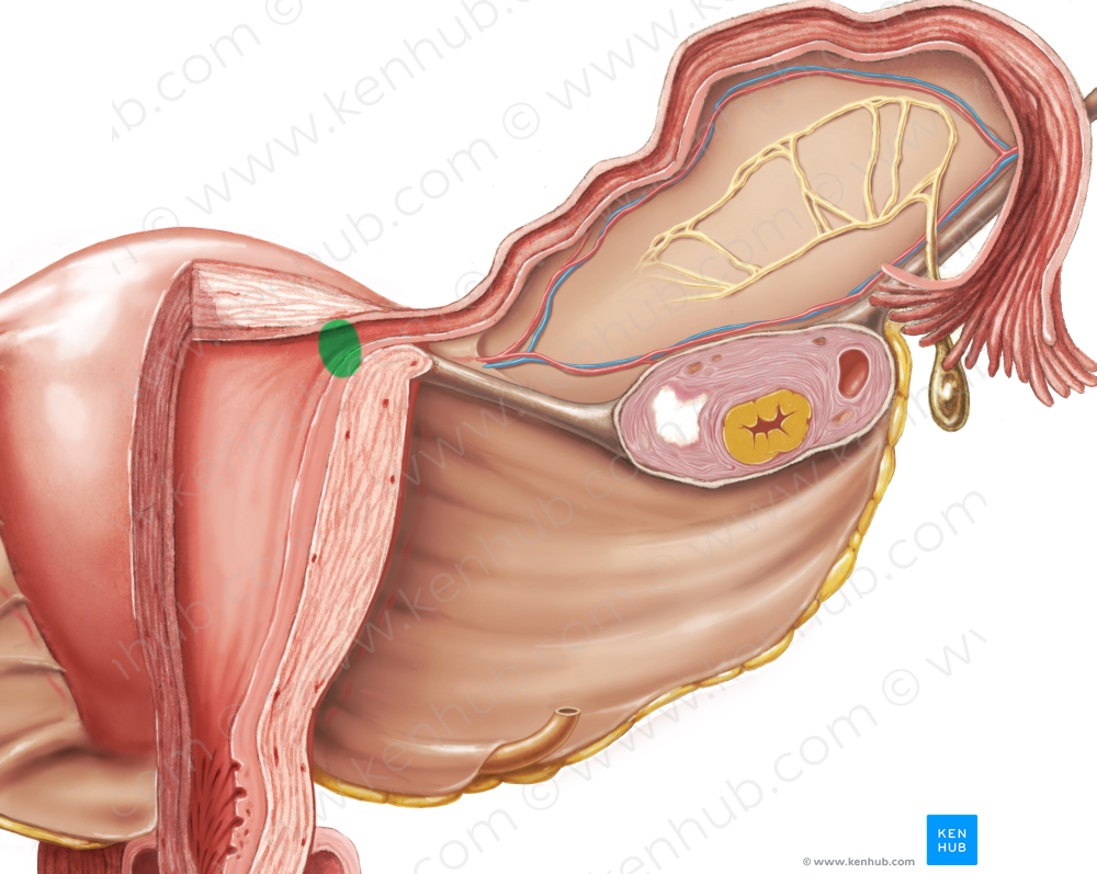 Uterine ostium of uterine tube (#7566)