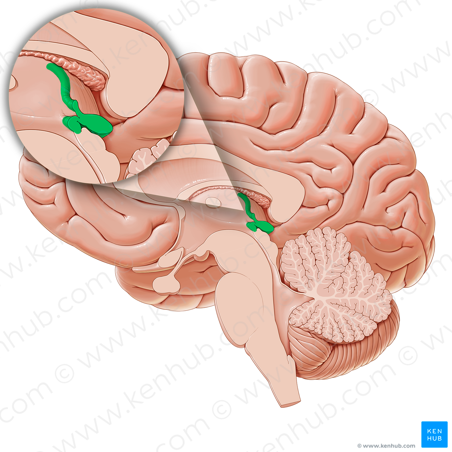 Epithalamus (#21235)