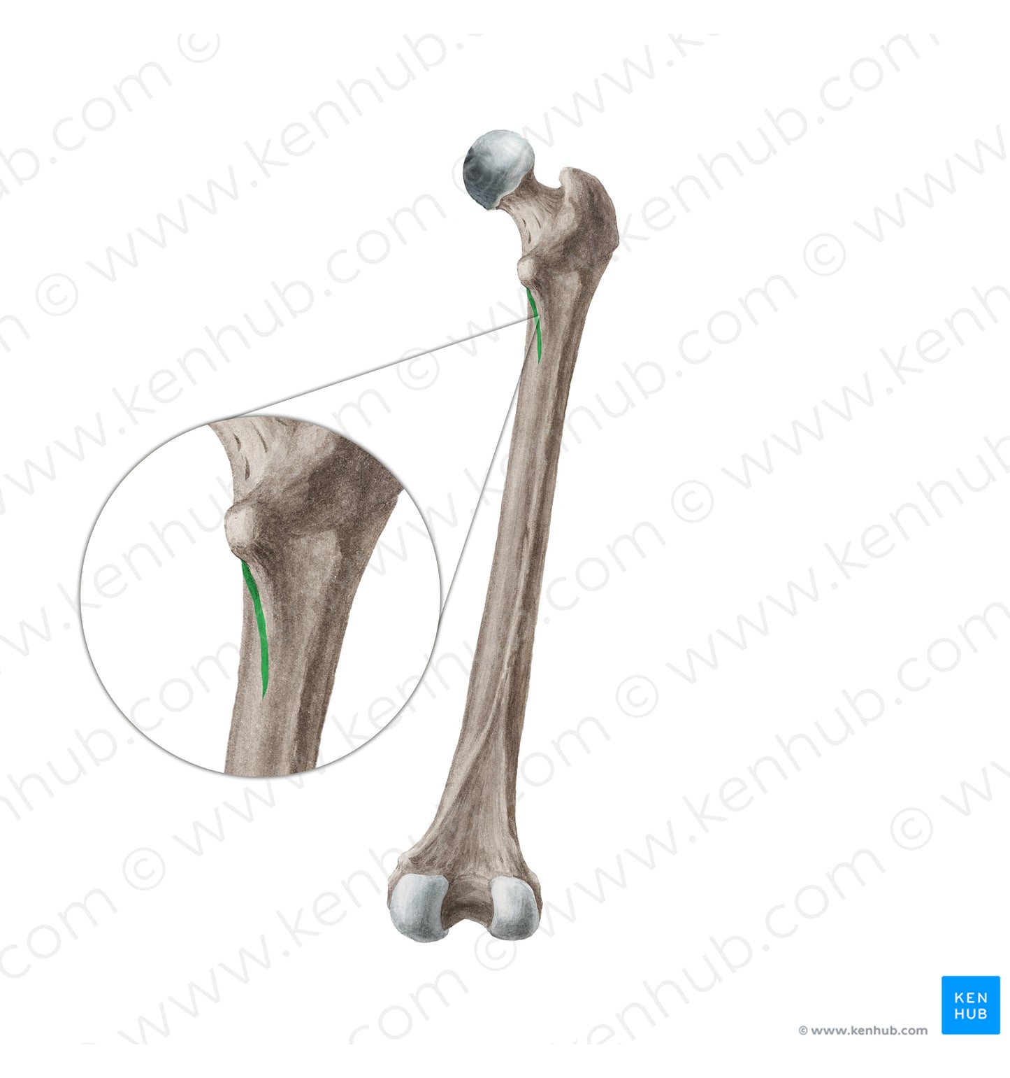 Spiral line of femur (#19965)