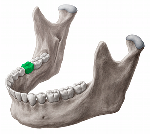 Mandibular right first molar tooth (#12856)