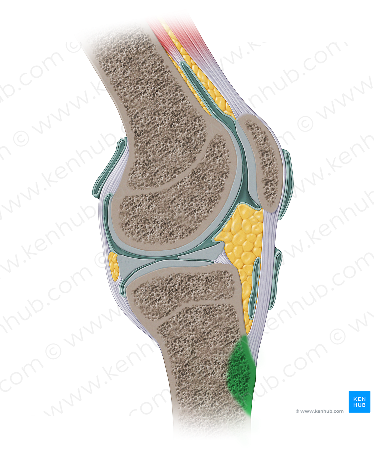 Tibial tuberosity (#13928)