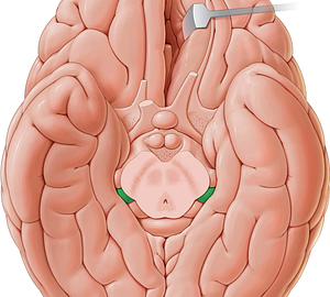 Medial geniculate body (#2948)