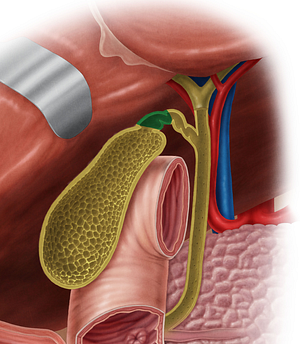 Neck of gallbladder (#2698)