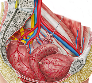 Left iliolumbar artery (#1440)