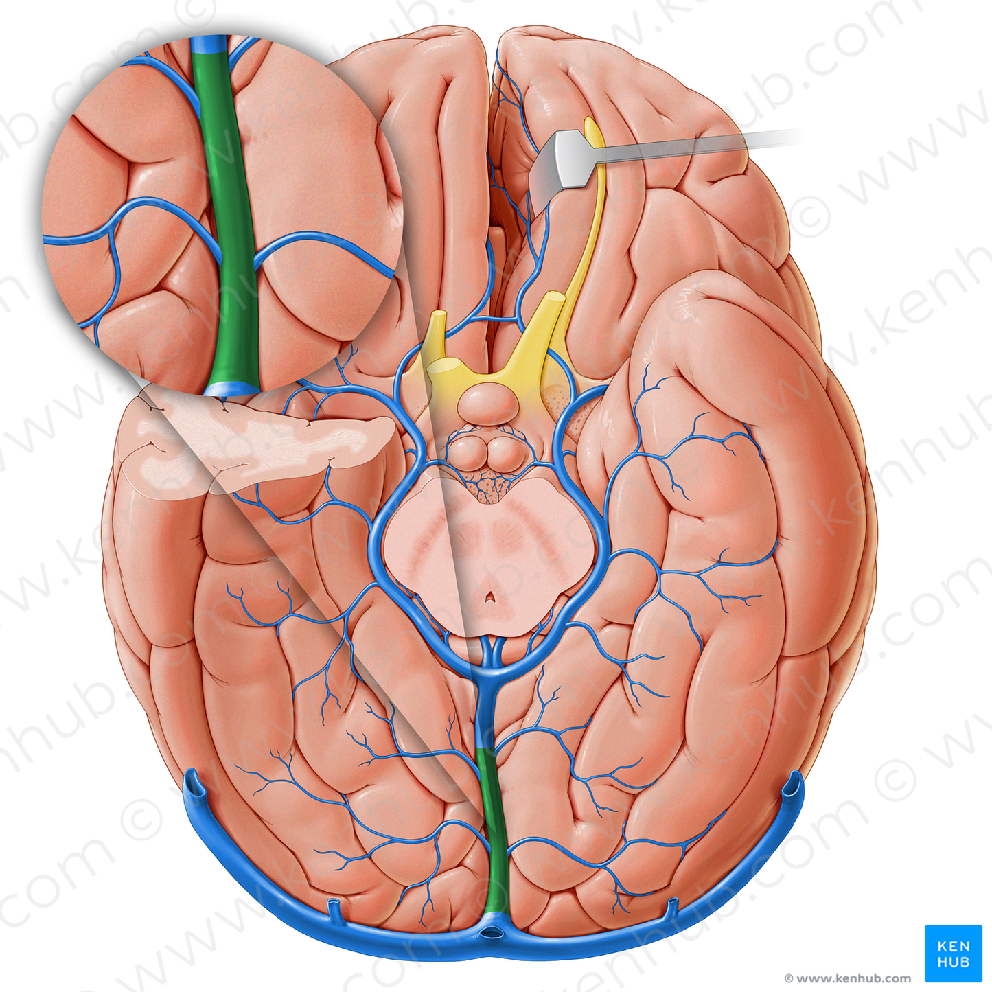 Straight sinus (#18237)