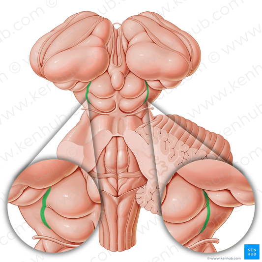 Lateral groove of midbrain (#21209)