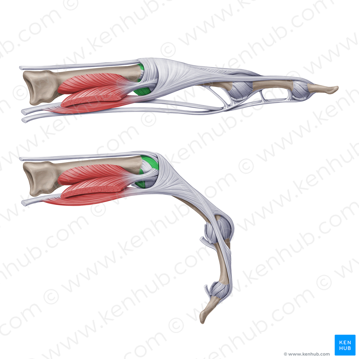 Accessory collateral metacarpophalangeal ligaments (#20947)