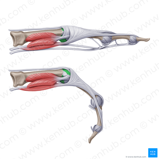Accessory collateral metacarpophalangeal ligaments (#20947)