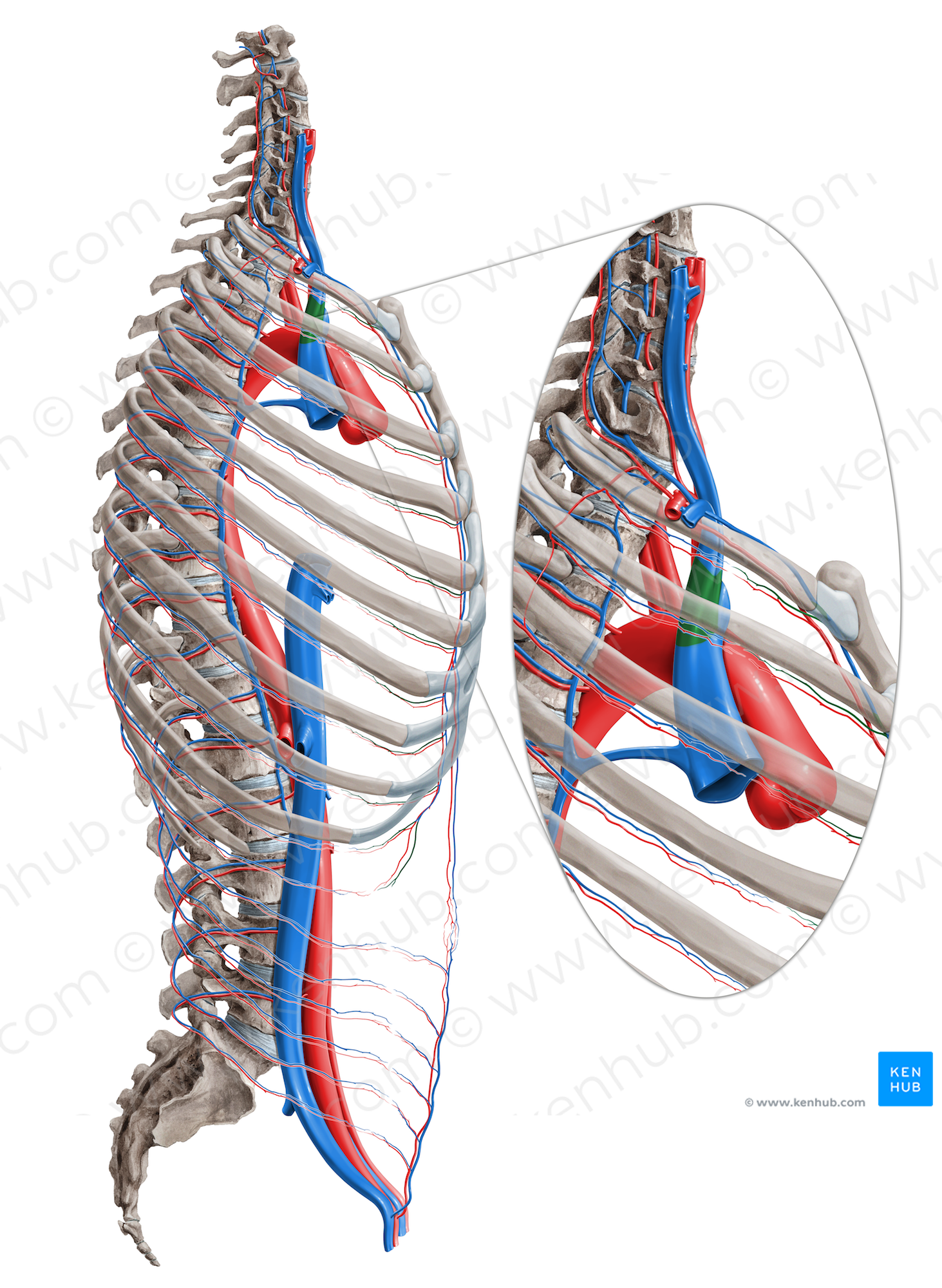 Right brachiocephalic vein (#10006)