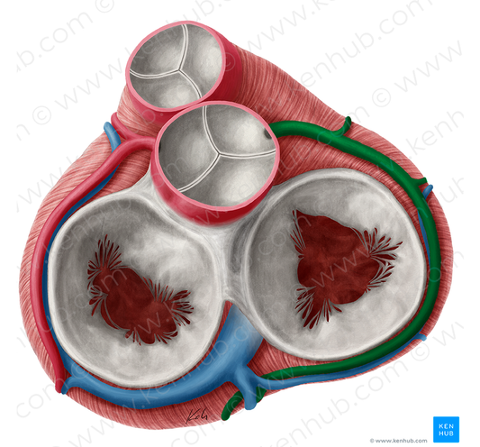 Right coronary artery (#1090)