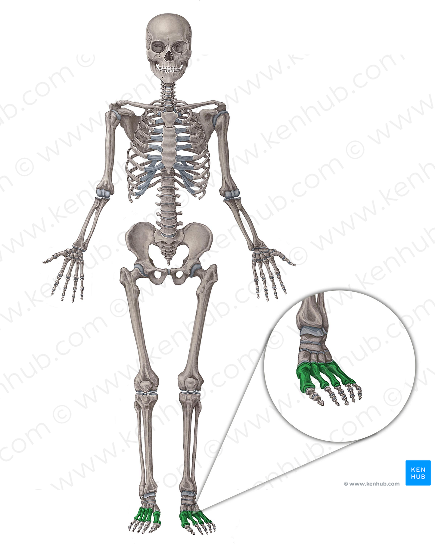 Metatarsal bones (#7501)