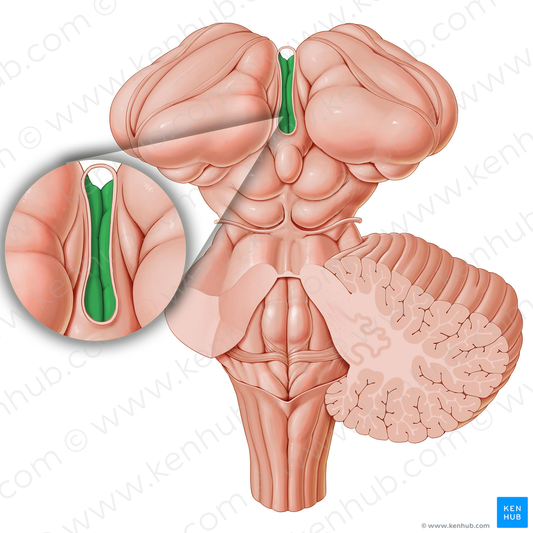 Third ventricle (#10732)