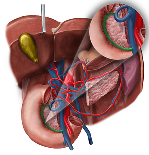 Anterior pancreaticoduodenal veins (#10459)