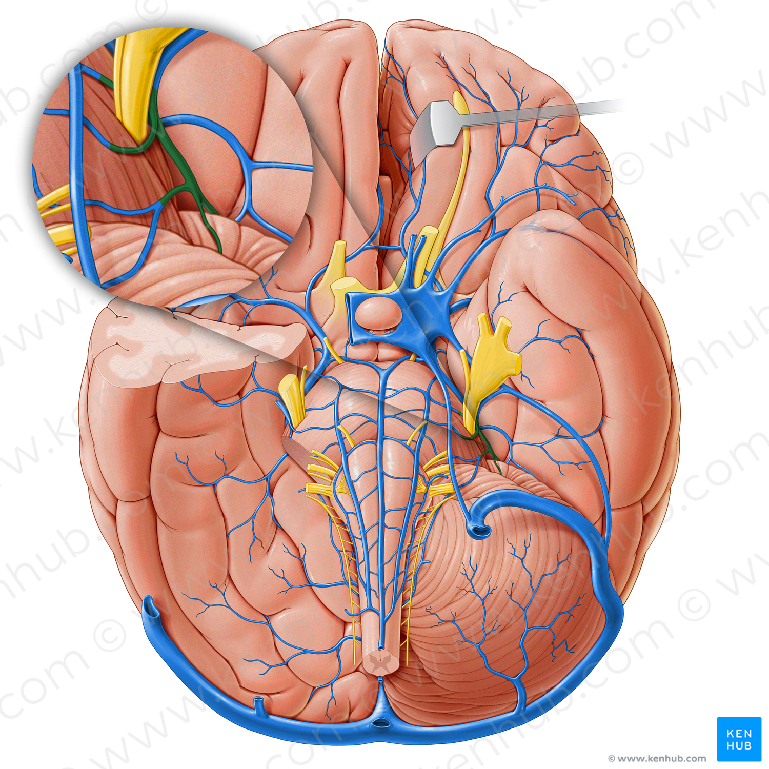 Superior cerebellar vein (#18239)