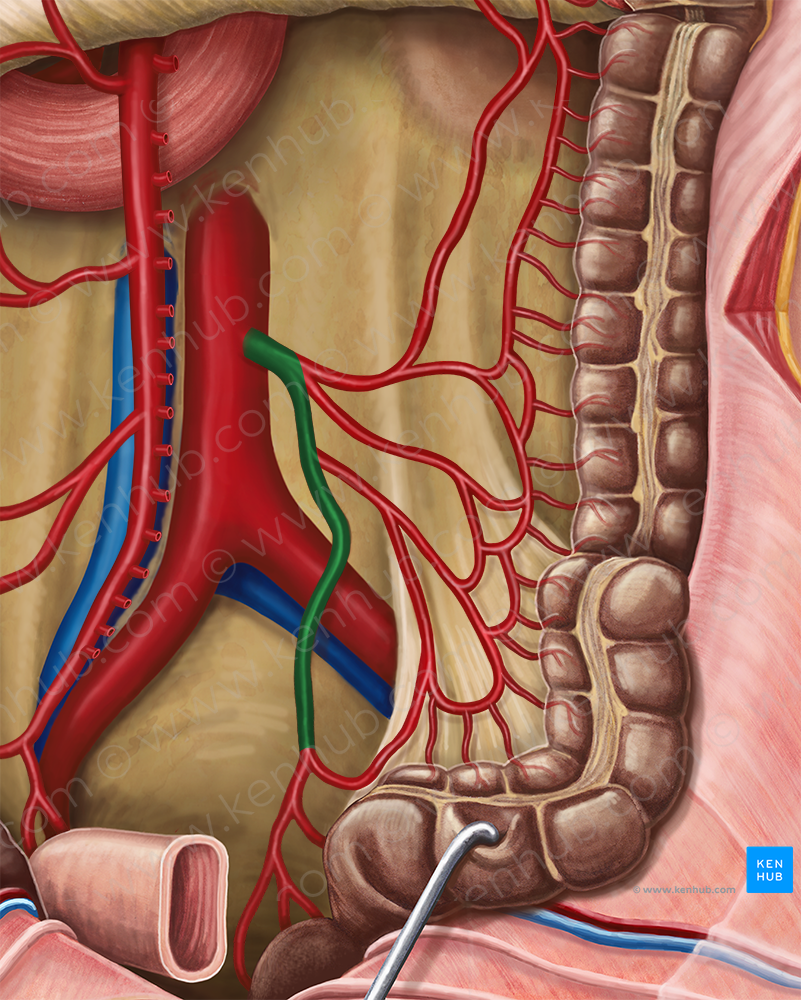 Inferior mesenteric artery (#1523)