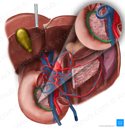 Anterior pancreaticoduodenal veins (#10461)