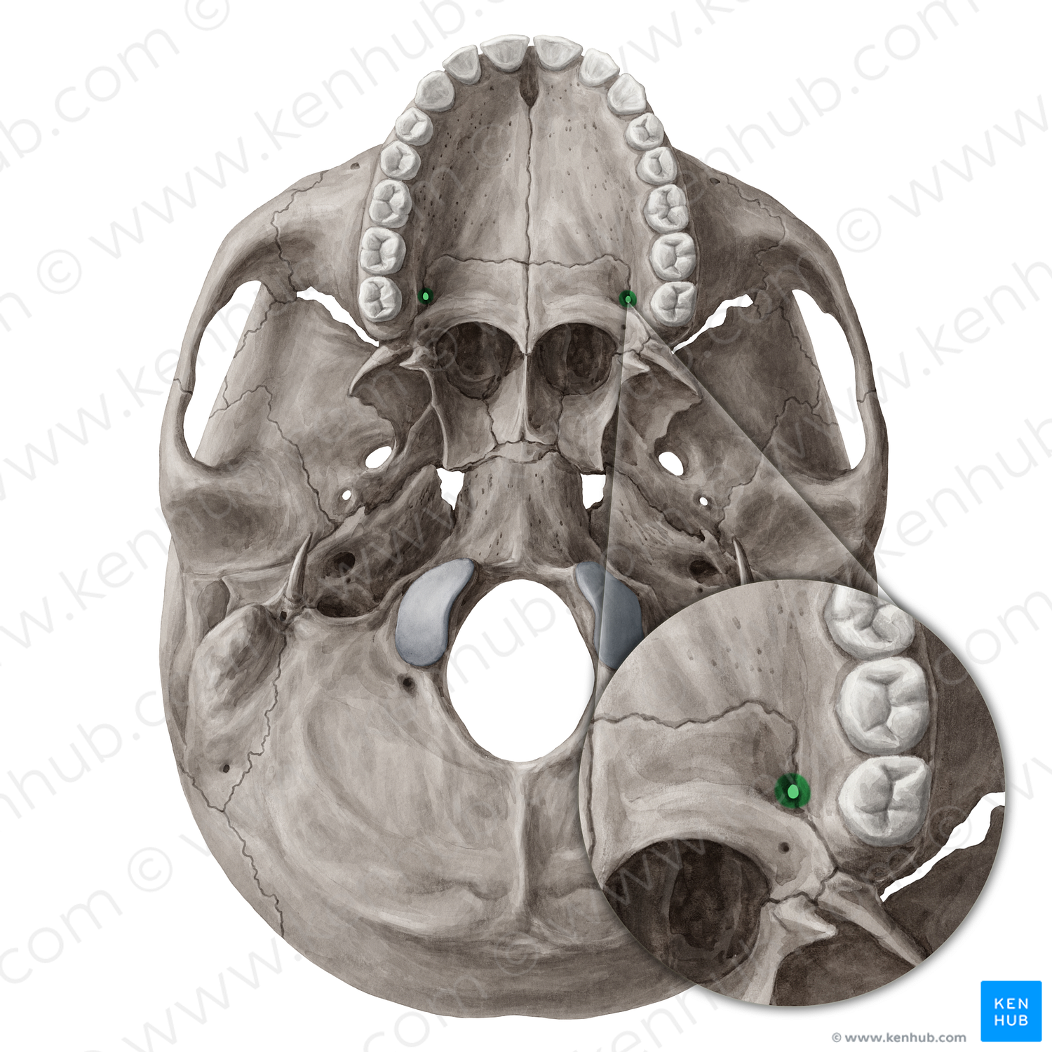 Greater palatine foramen (#3793)